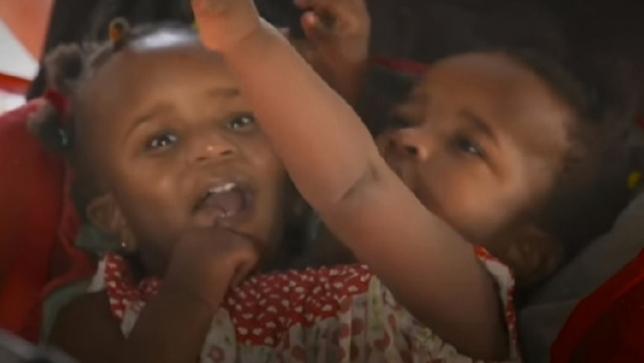 Sijamske bliznakinje