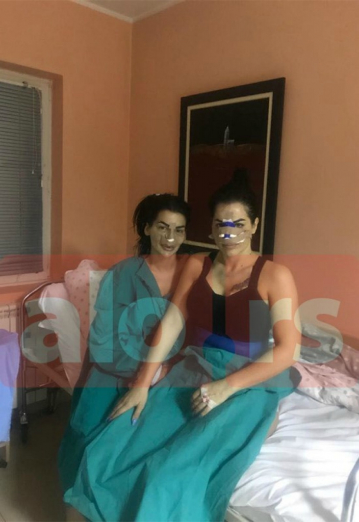 Šmizla i Dina se operisale