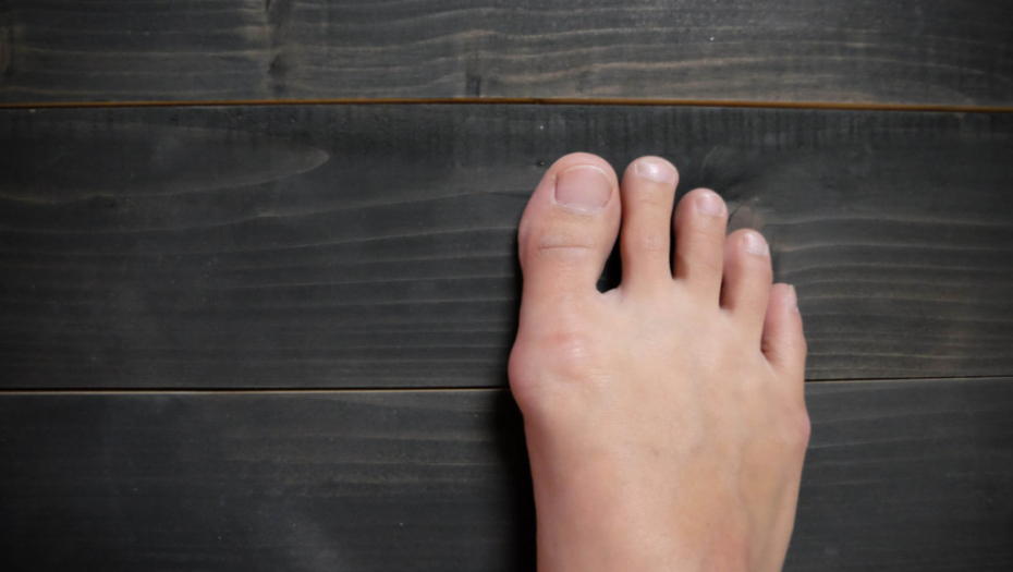 STOPALA, ČUKLJEVI, NOGA