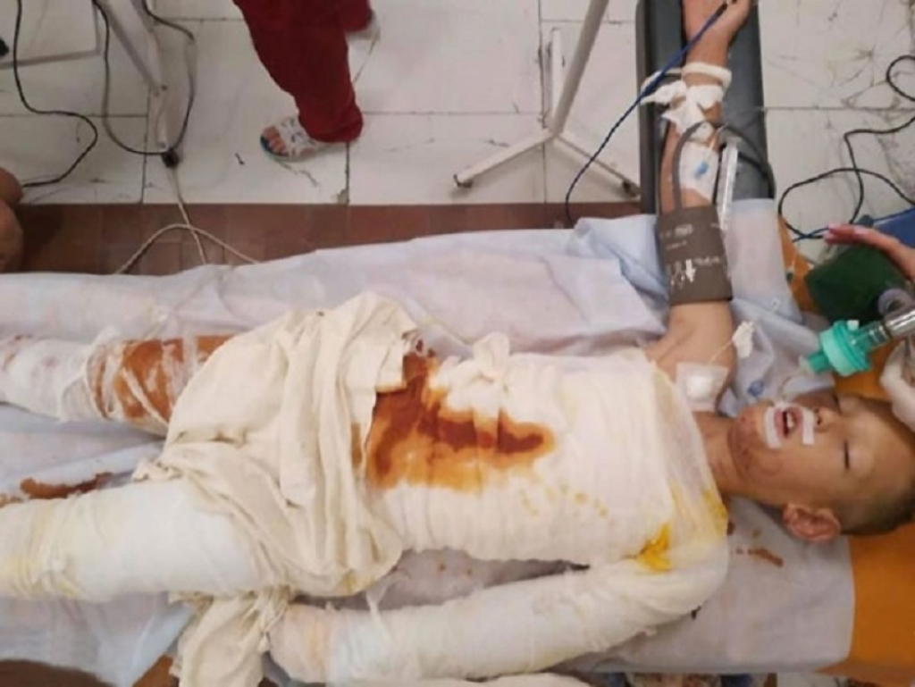 Osmogodišnjak iz Ukrajine