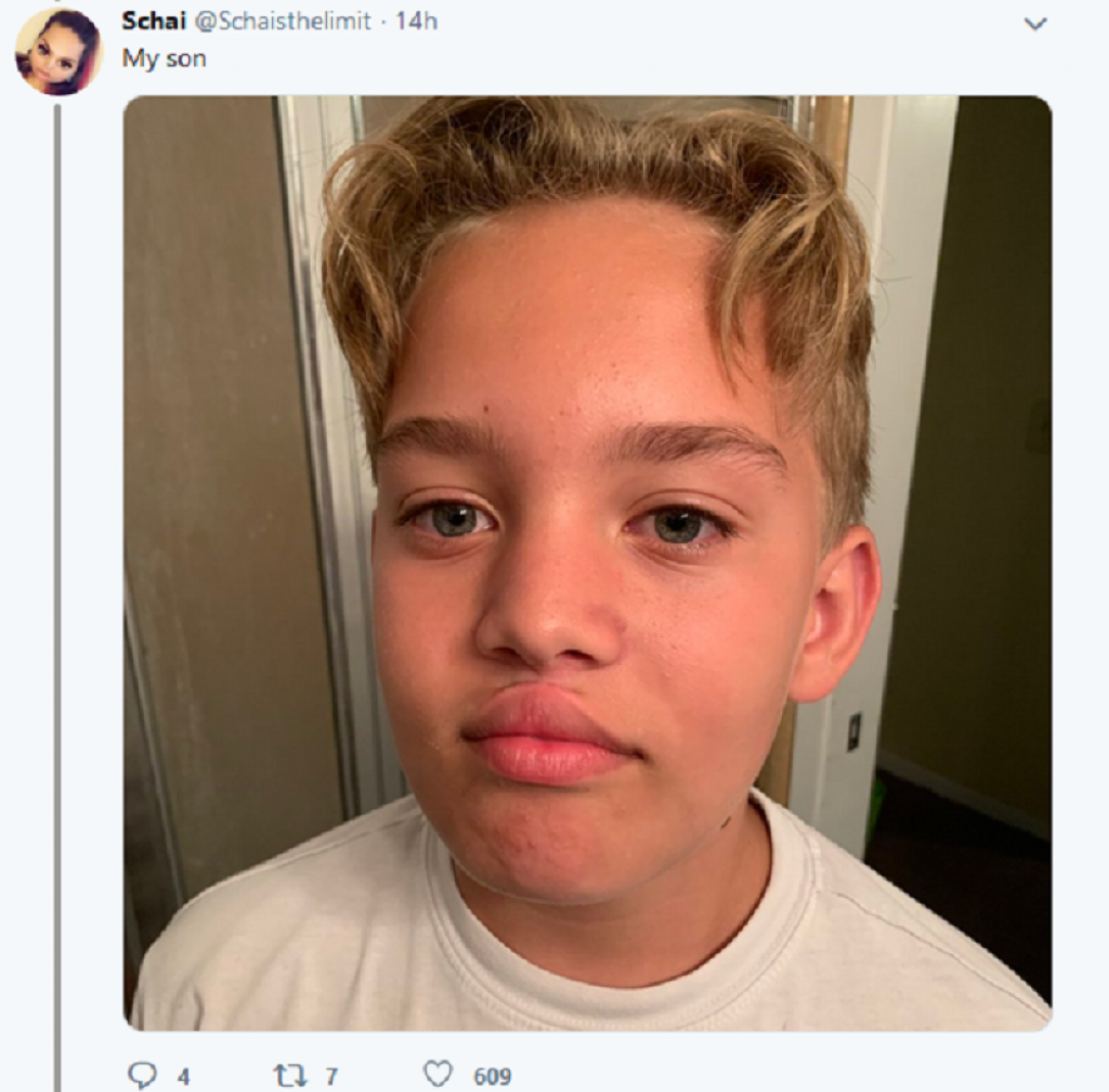 povećanje usana lepkom, dete, 