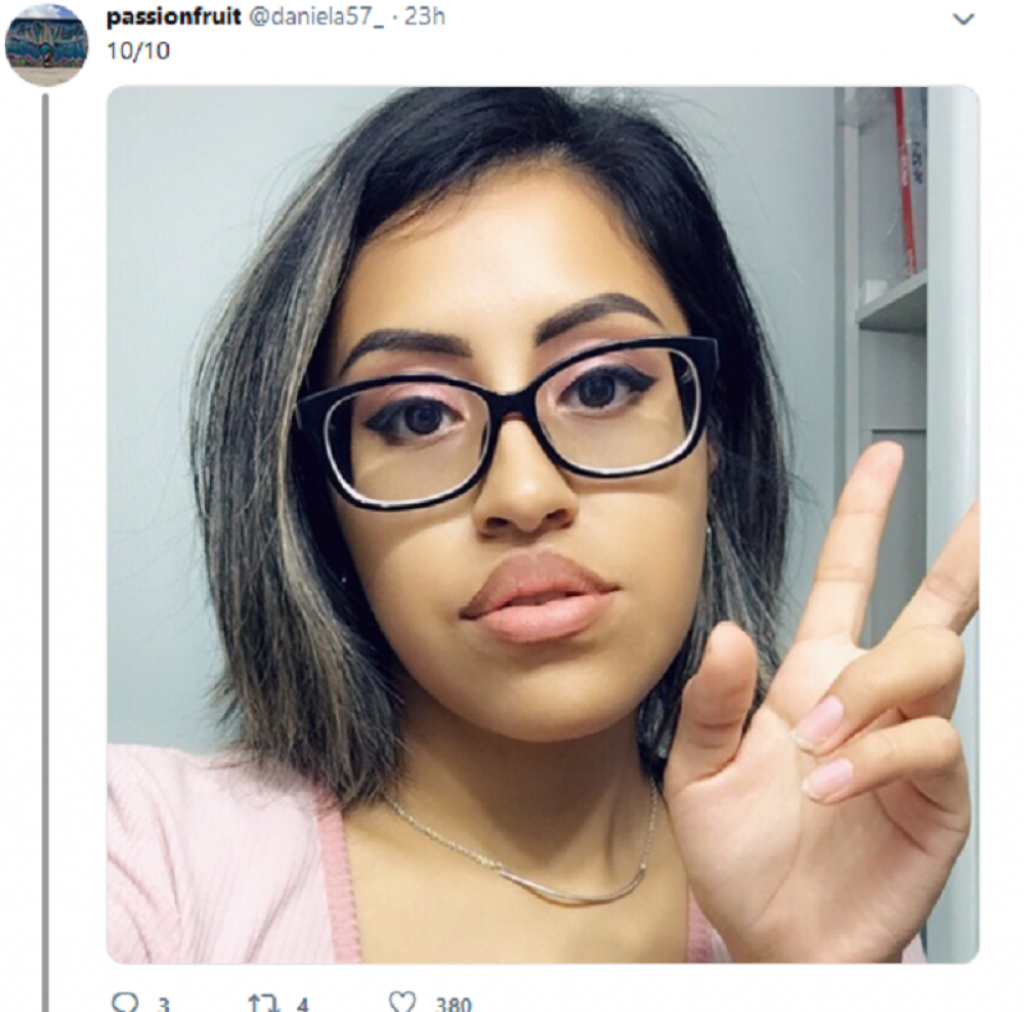 povećanje usana lepkom