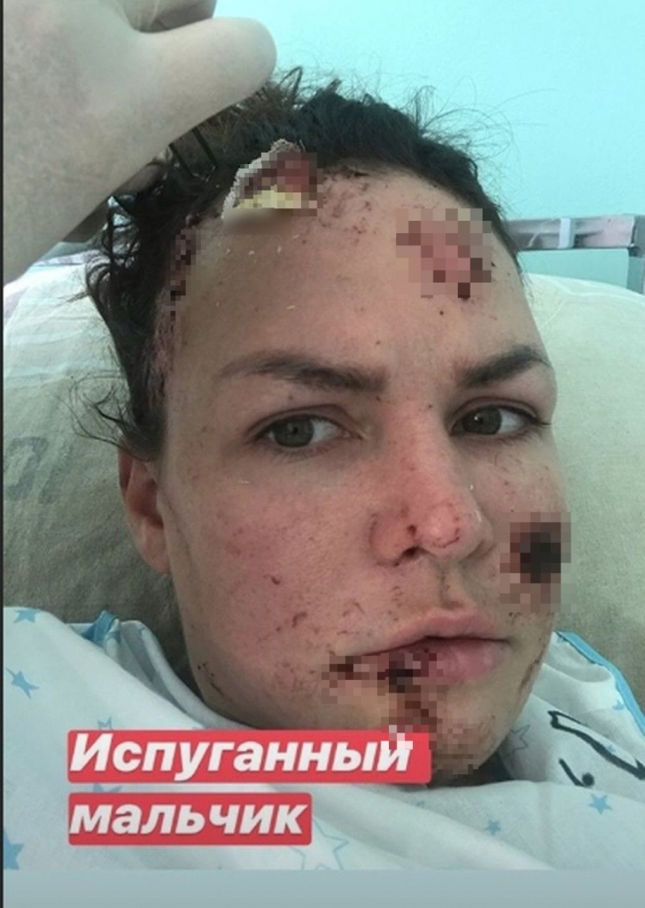 Evgenija Smetanina, 0476869389