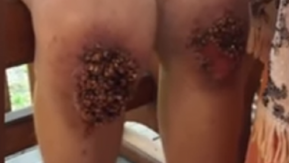 Kolena dečaka koji je klečao na kukuruzu