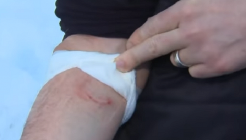 Muškarac ubio kojota golim rukama