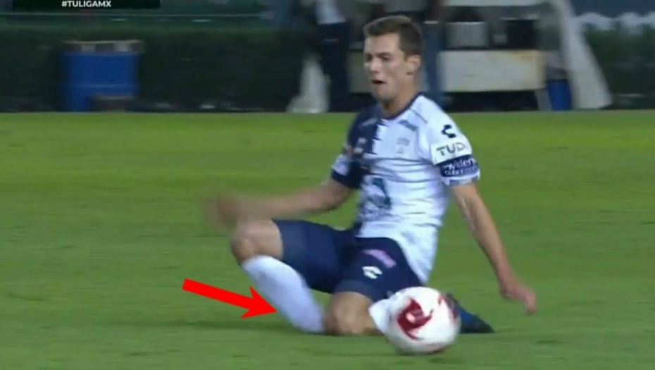 debitovao pa se povredio