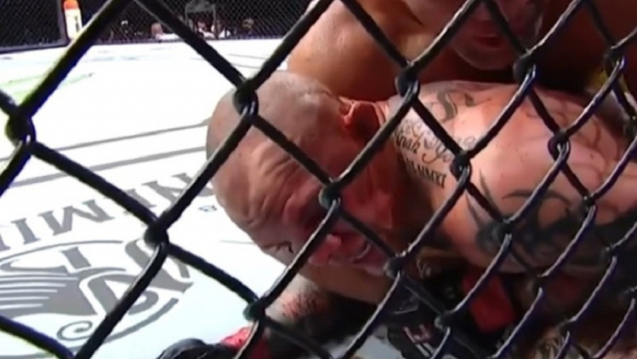 Entoni Smit - Glover Tešeira