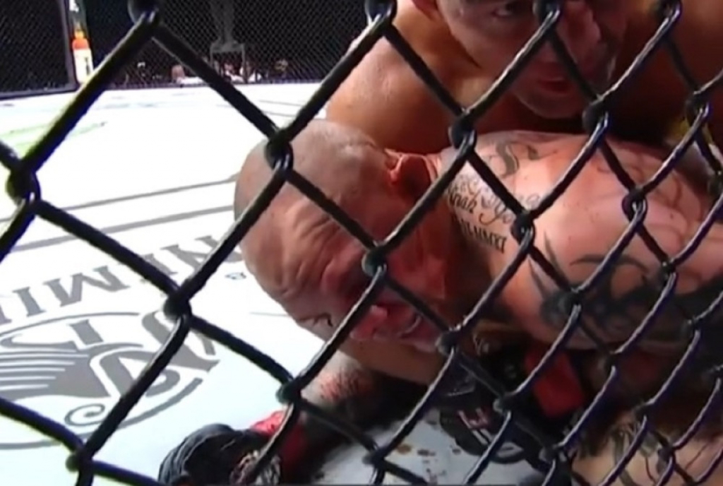 Entoni Smit - Glover Te&scaron;eira