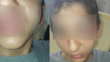 Pretučeni dečak Gabrijel Đorđević