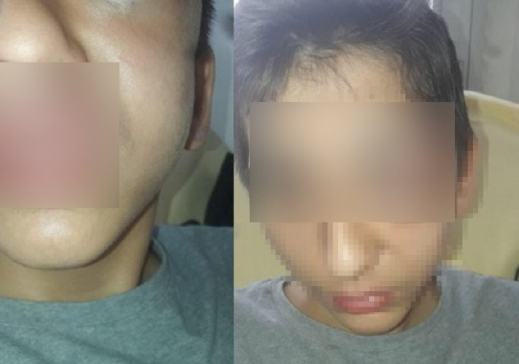 Pretučeni dečak Gabrijel Đorđević