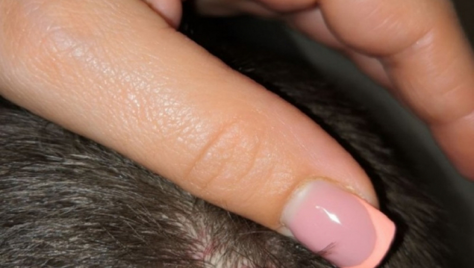 Pretučeni dečaci u Boljevcima 