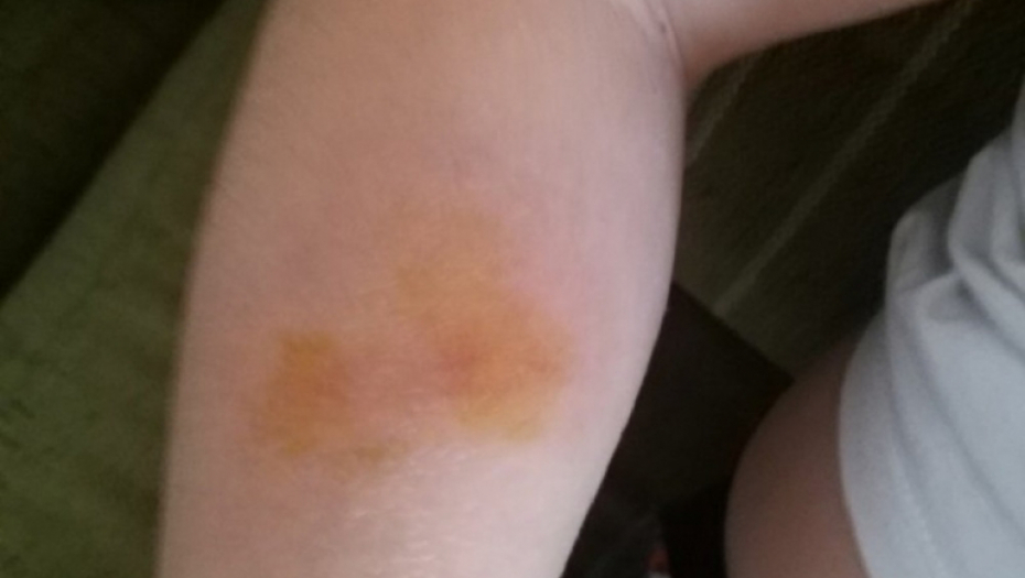 Pretučeni dečaci u Boljevcima 