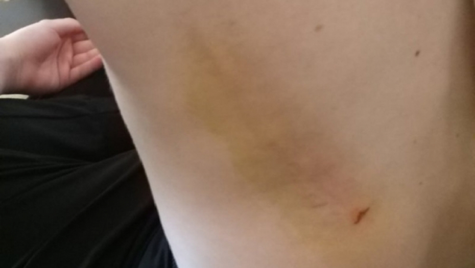 Pretučeni dečaci u Boljevcima 