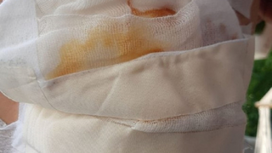 Pretučeni dečaci u Boljevcima 