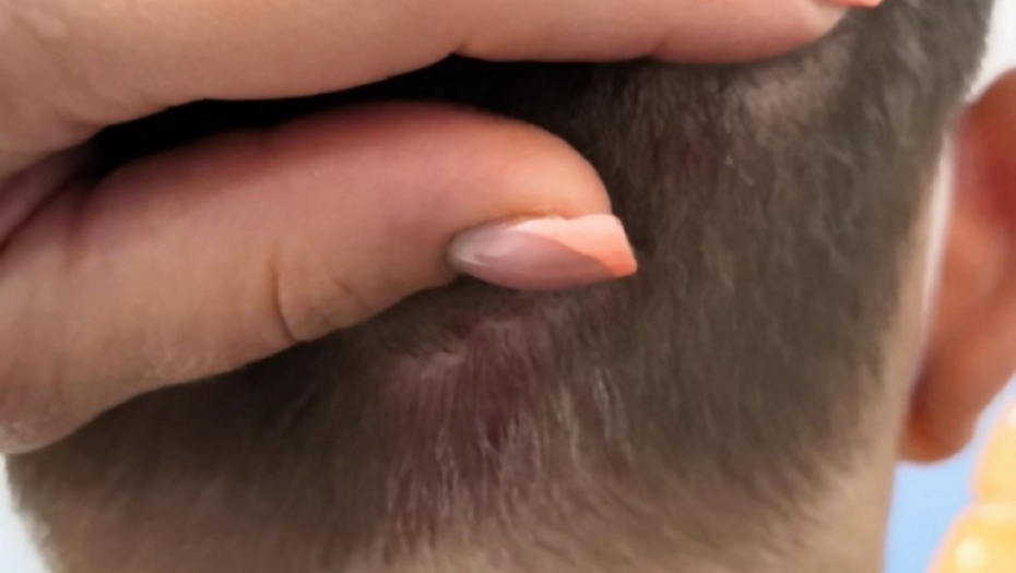 Pretučeni dečaci u Boljevcima 