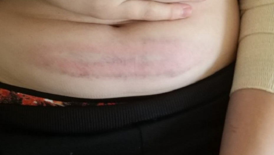 Pretučeni dečaci u Boljevcima 