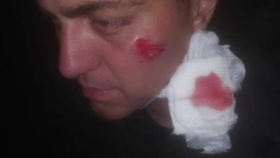 Povređeni policajci u neredima demonstranata 