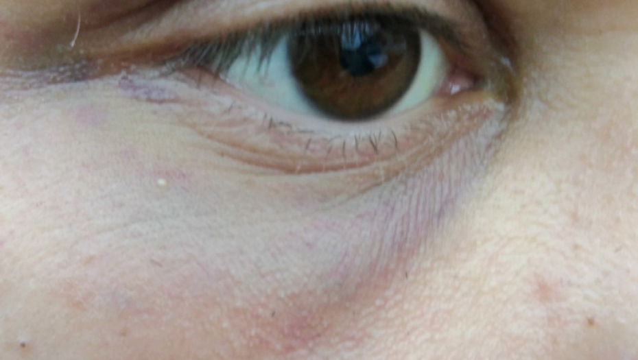 Mladić iz Bele Crkve