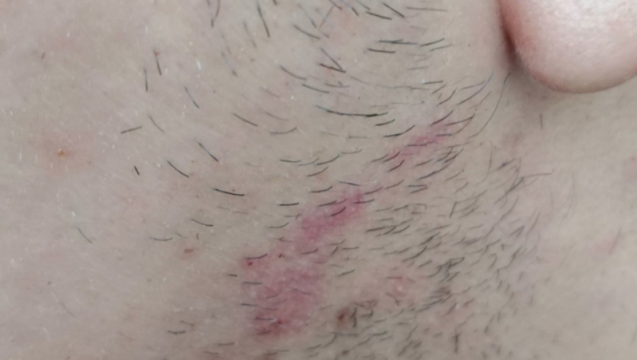 Mladić iz Bele Crkve