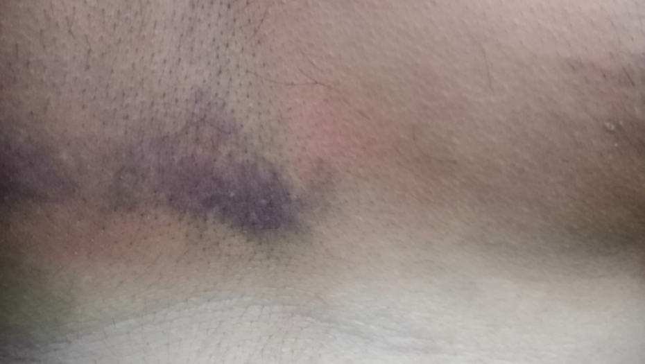 Mladić iz Bele Crkve