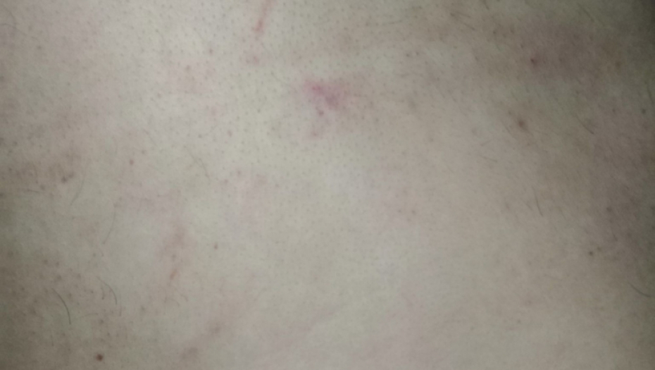 Mladić iz Bele Crkve