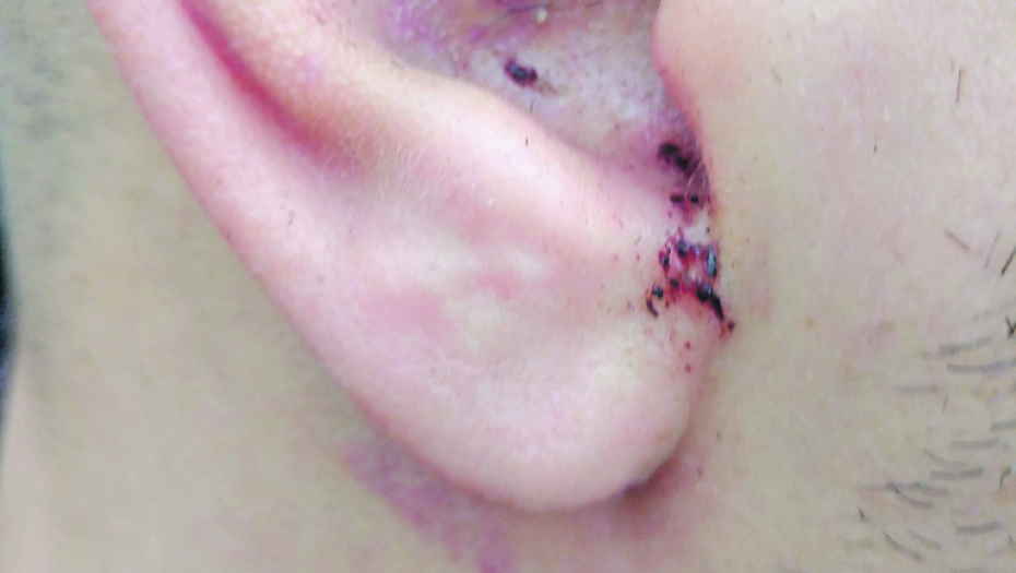 Mladić iz Bele Crkve