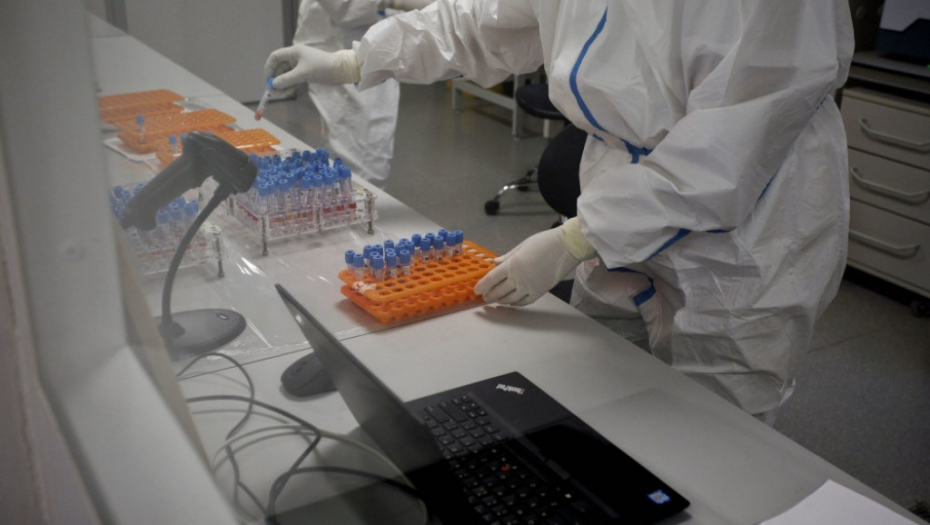 Vatreno oko, korona, test