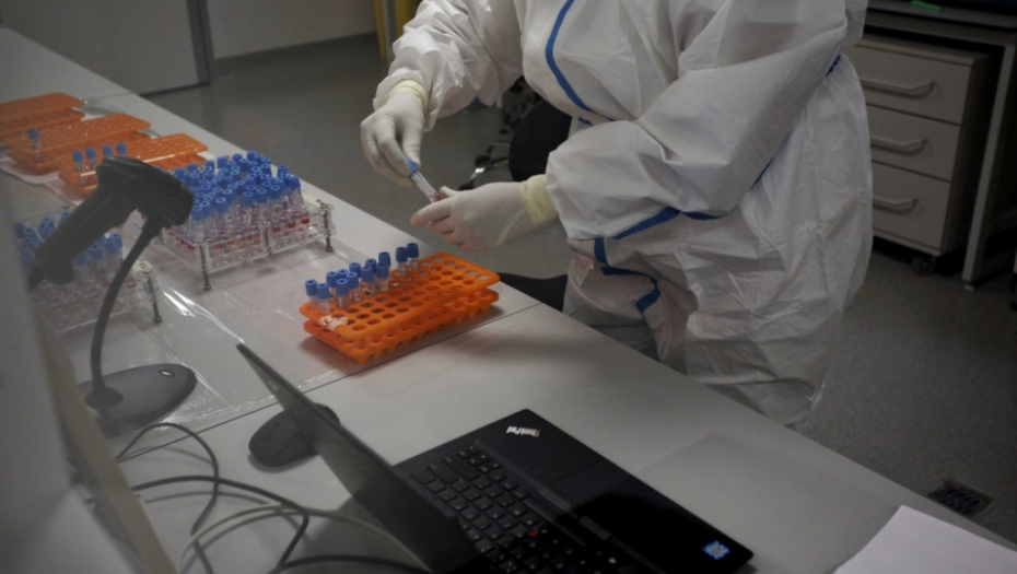 Vatreno oko, korona, test