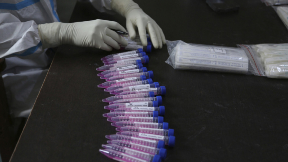 Korona, testovi, test