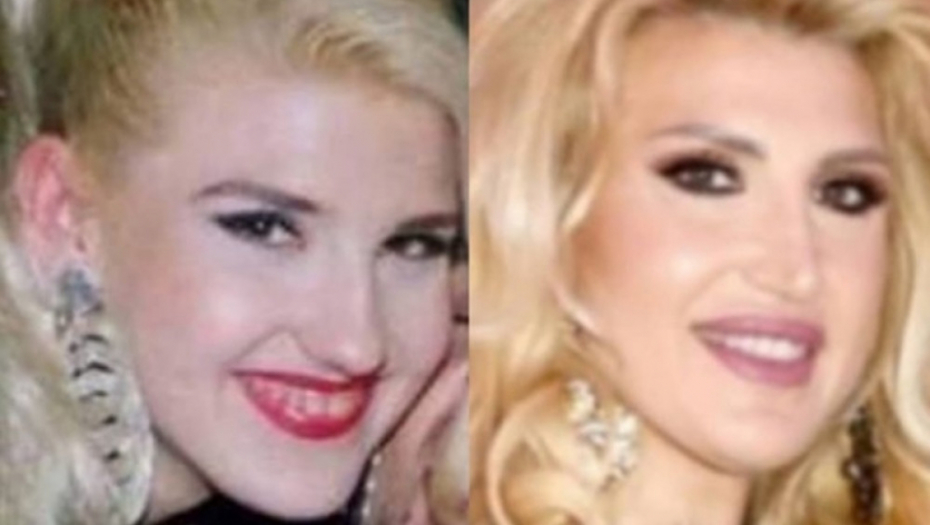 Poznati PRE I POSLE operacija