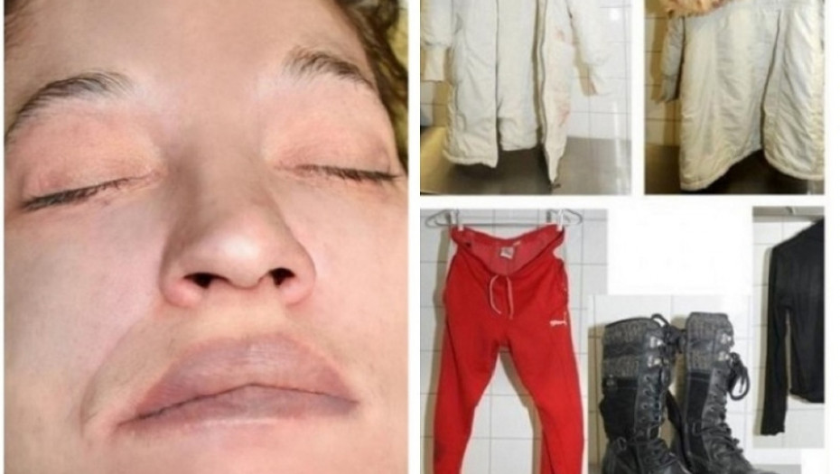 Ubijena žena sa tetovažom cveća