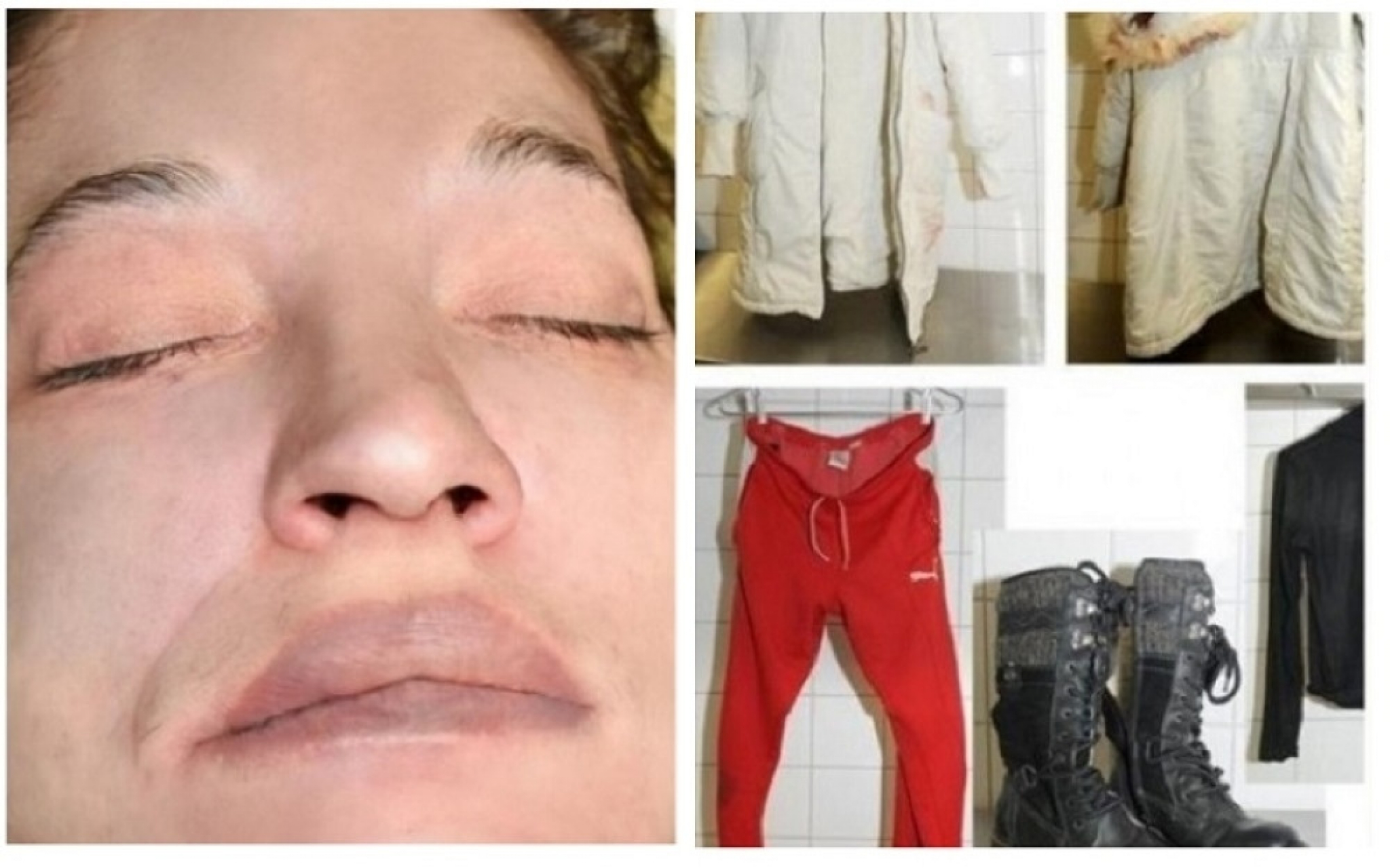 Ubijena žena sa tetovažom cveća