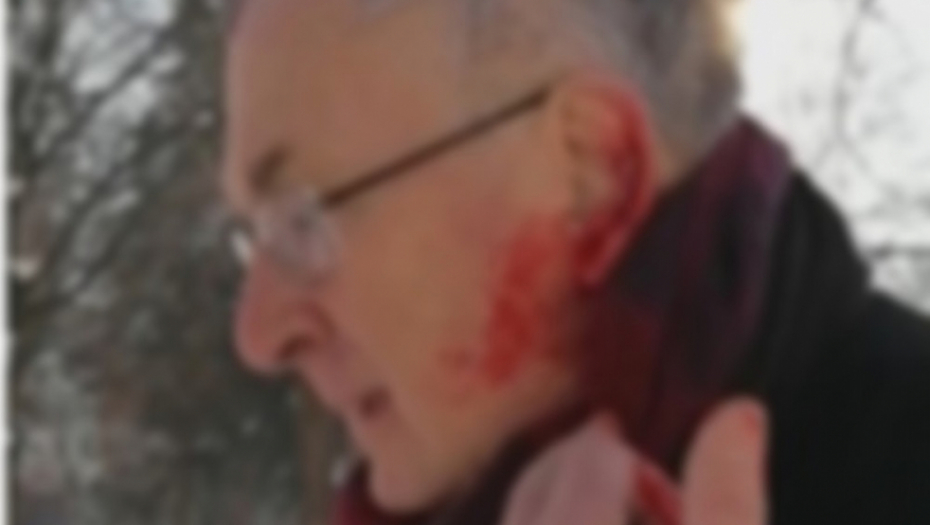 Napali ga psi lutalice