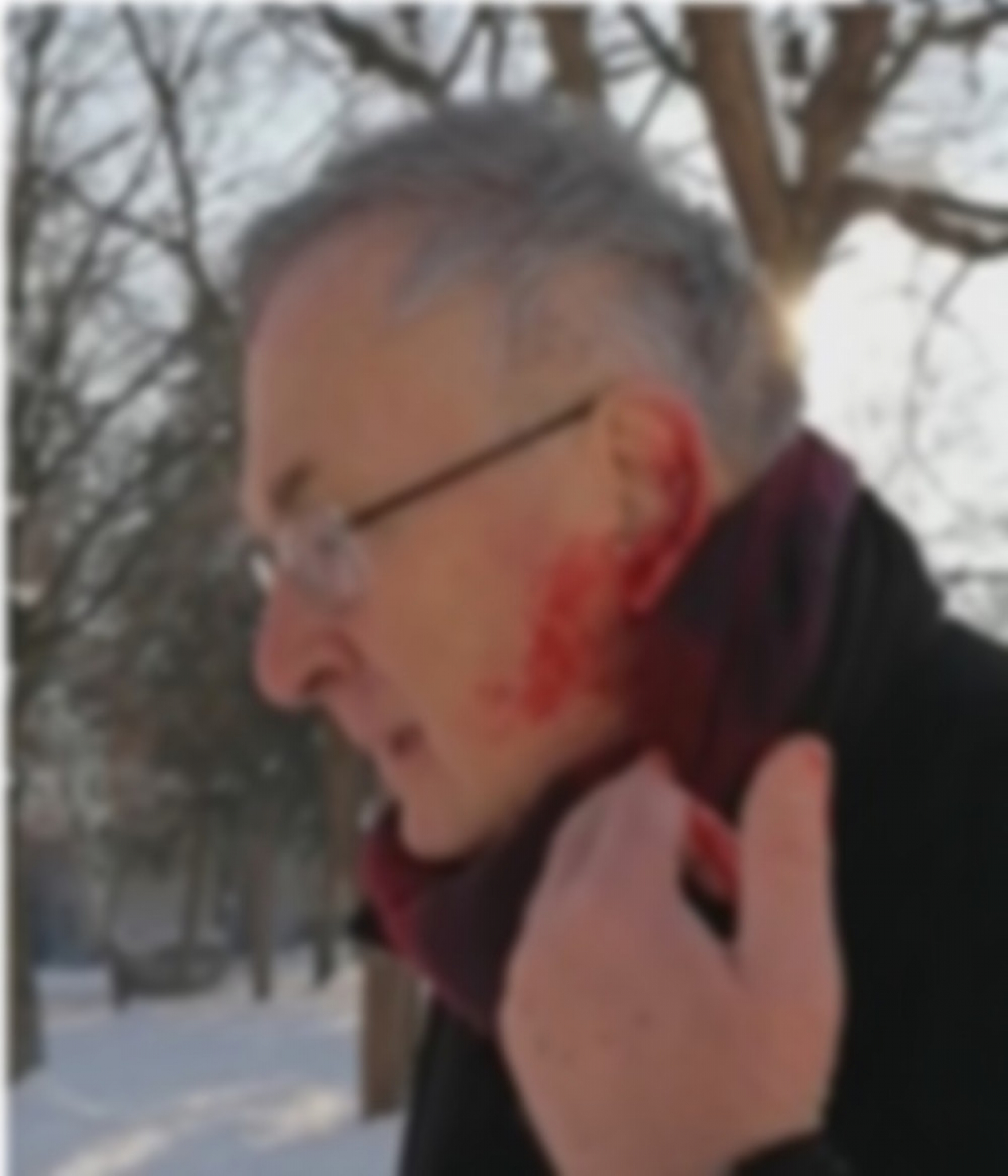 Napali ga psi lutalice