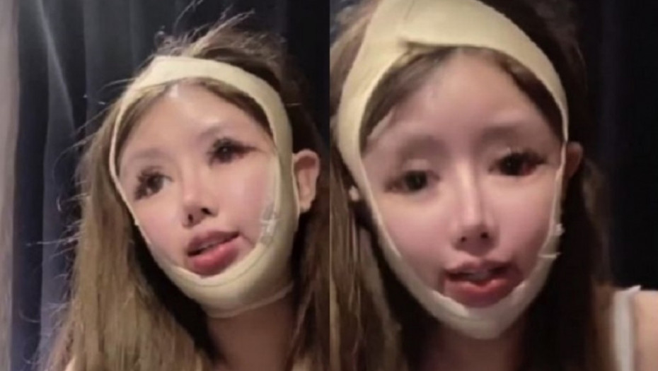 Zavisnica od estetskih operacija