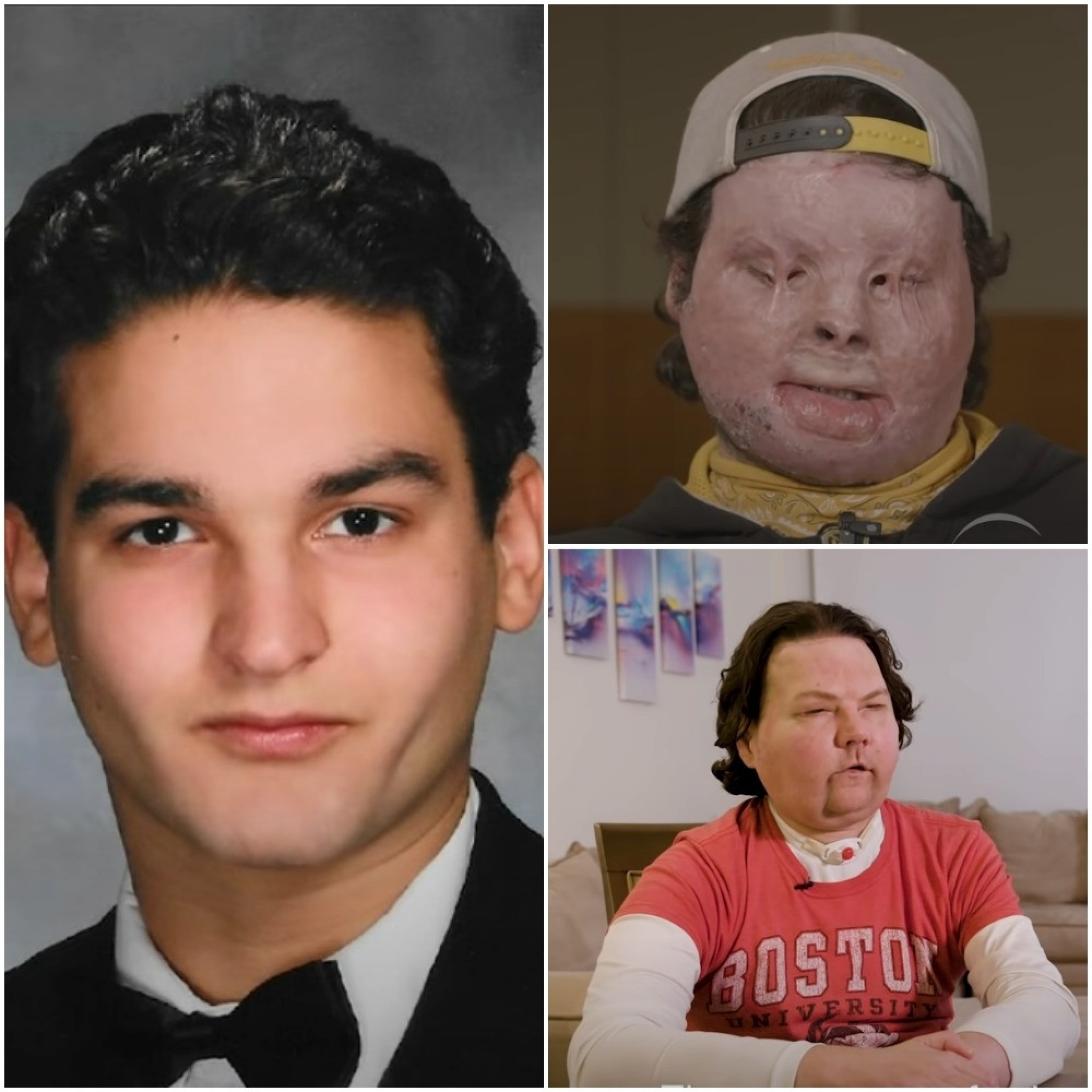 mladič, saobračajna nezgoda, operacija