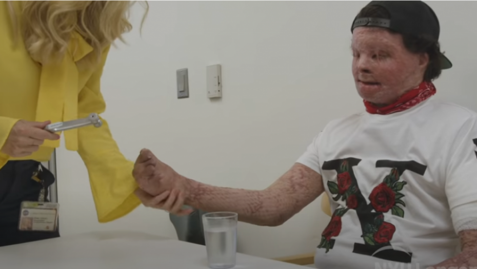 operacija, transplatacija