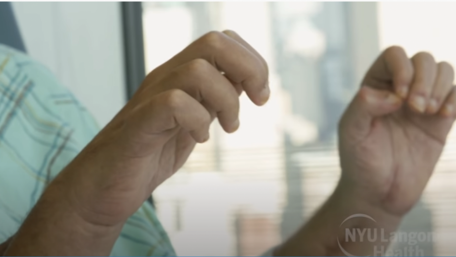 operacija, transplatacija