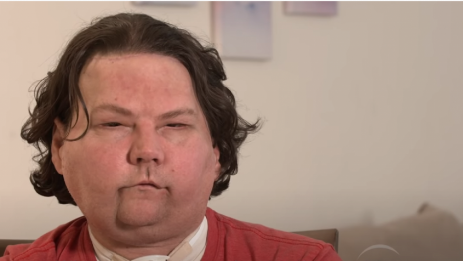 operacija, transplatacija