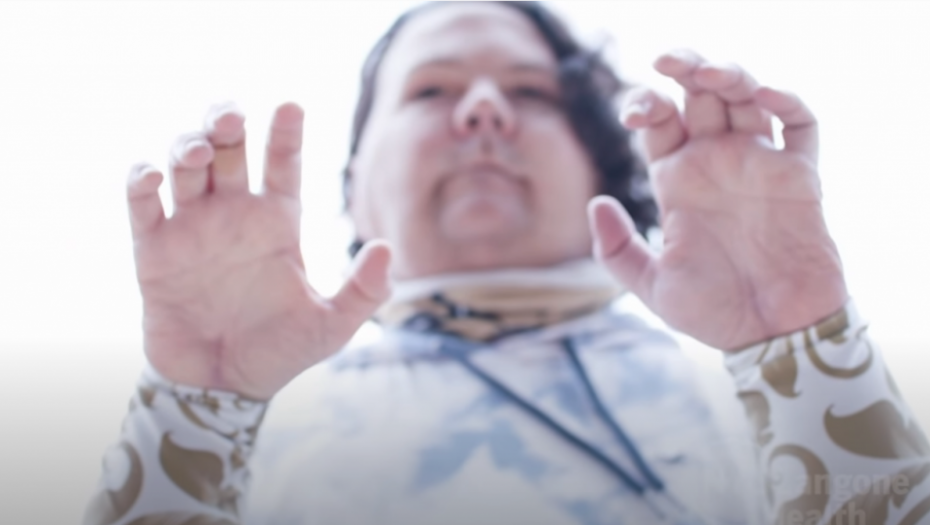 operacija, transplatacija