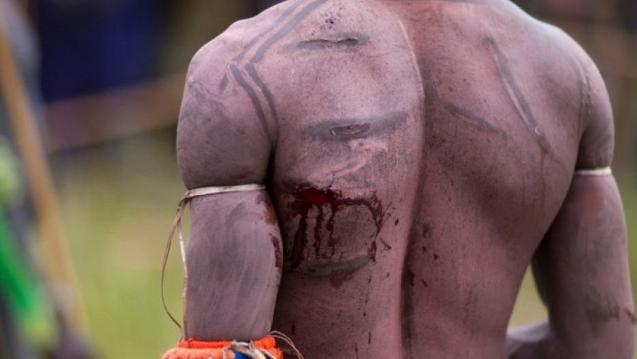 Pleme Suri, Donga, Borba