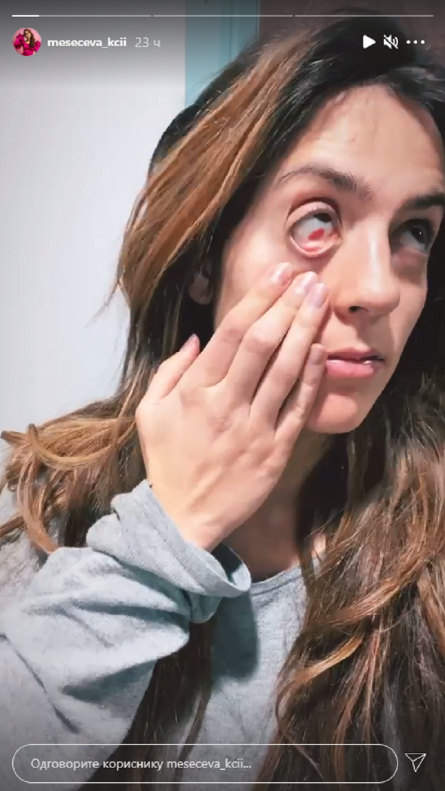 Naša poznata glumica zadobila jezive povrede na snimanju, objavila video i šokirala sve! (VIDEO)