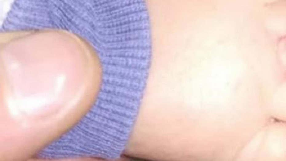 LEKARI VODE TEŠKU BITKU Detalji zdravstvenog stanja bebe u Kragujevcu