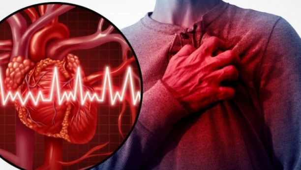 DOKTORI UPOZORAVAJU: Ovih pet simptoma, čak mesec dana pre, najavljuju srčani udar!