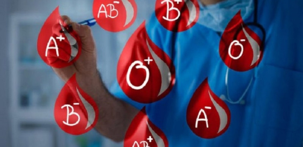 PODATAK KOJI VAM MOŽE SAČUVATI GLAVU Ako imate ovu krvnu grupu, morate znati jednu stvar
