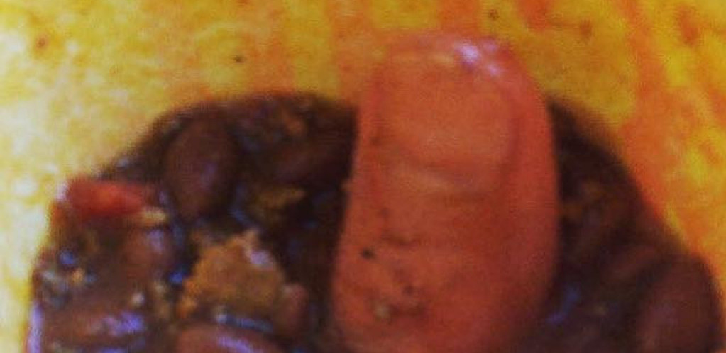 Ljudski prst u hrani ili prekratki sendvič: Najluđe pokrenute tužbe protiv lanaca brze hrane