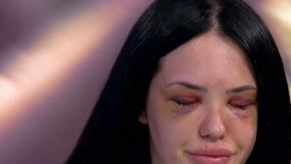 VUKAO ME JE MODRU PO BETONU! Drugarica Tijane Afjon prvi put u emisiji puna podliva, skrhana uspela da izusti samo jedno, a otkrila i nove detalje brutalnog prebijanja!