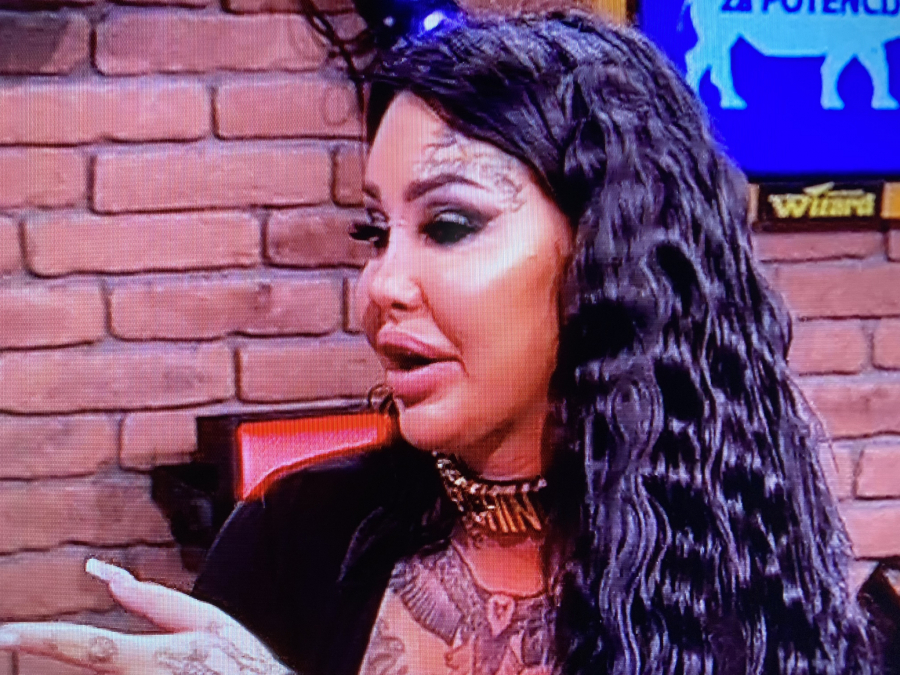 JEZIVO Amidžić ugostio Anđelu, a njeno lice potpuno deformisano od operacija!