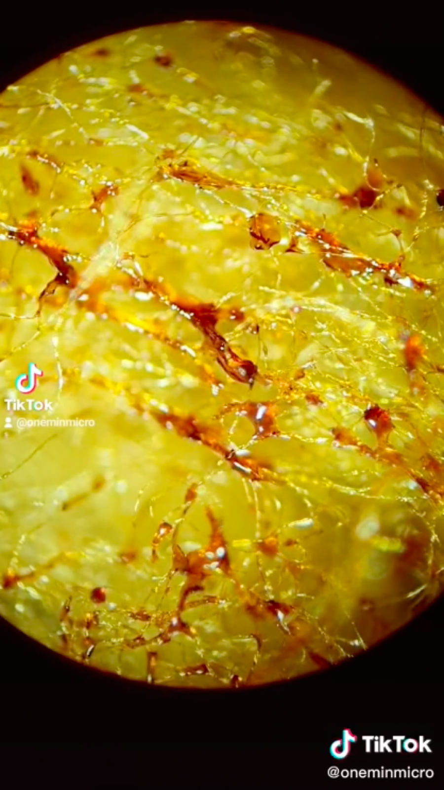 I JEDNA CIGARETA NAM MNOGO ŠTETI Tiktoker je pokazao zastrašujuću istinu pod mikroskopom! (VIDEO)