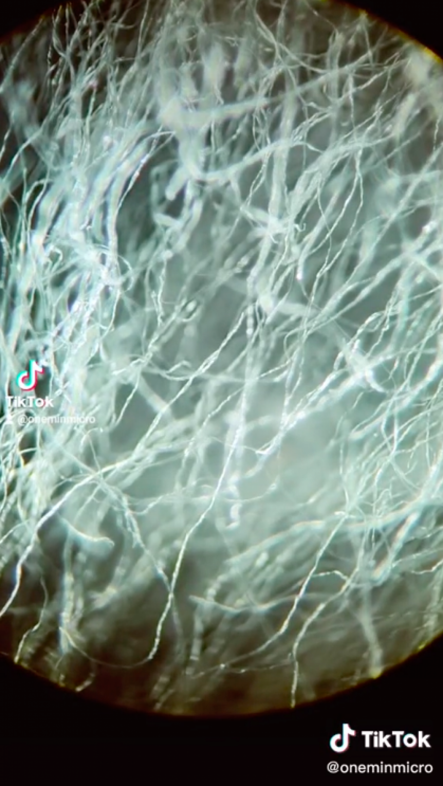 I JEDNA CIGARETA NAM MNOGO ŠTETI Tiktoker je pokazao zastrašujuću istinu pod mikroskopom! (VIDEO)